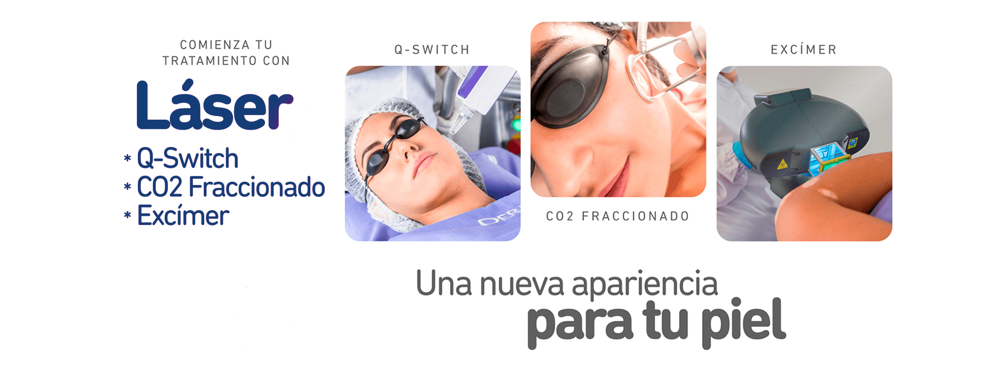laser_arequipa